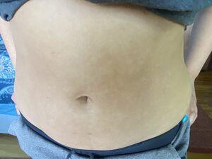 Abdomen